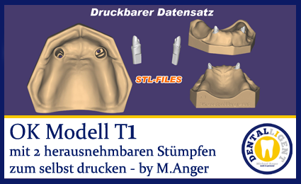 Artikelbild 1 des Artikels “OK-Modell T1-STL-Daten zum selbst drucken “