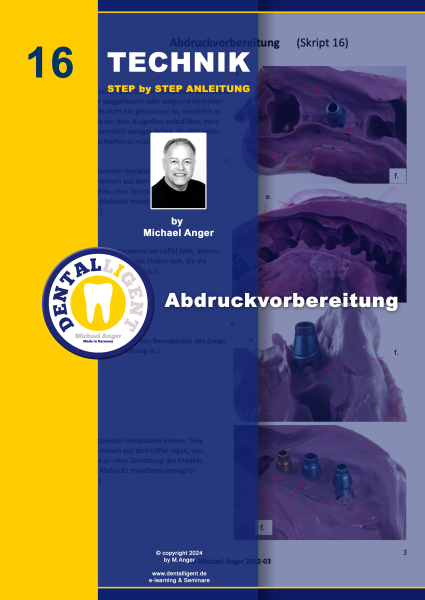 Product image 1 of the product “Technik Step by Step Anleitung - Nr. 16 Abdruckvorbereitung ”