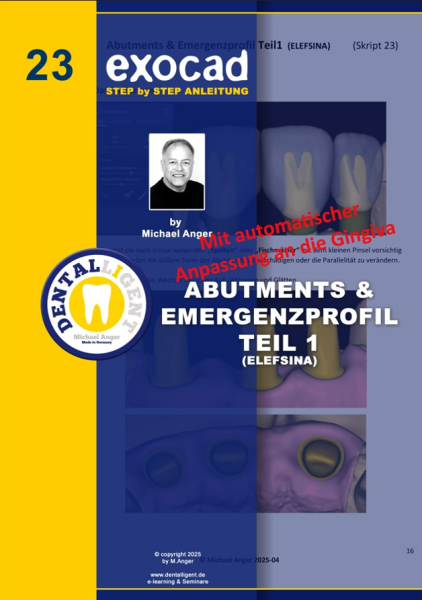 Product image 1 of the product “Exocad Step by Step Anleitung - Nr. 23 ABUTMENTS & EMERGENZPROFIL TEIL 1 in ELEFSINA ”