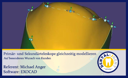 Product image 1 of the product “Primär- und Sekundärteleskope gleichzeitig modellieren ”