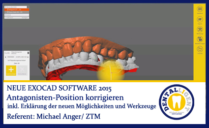 Product image 1 of the product “2015-Antagonisten-Position korrigieren - Exocad 2015 ”