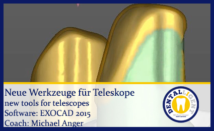 Artikelbild 1 des Artikels “2015-Neue Werkzeuge für Teleskope “