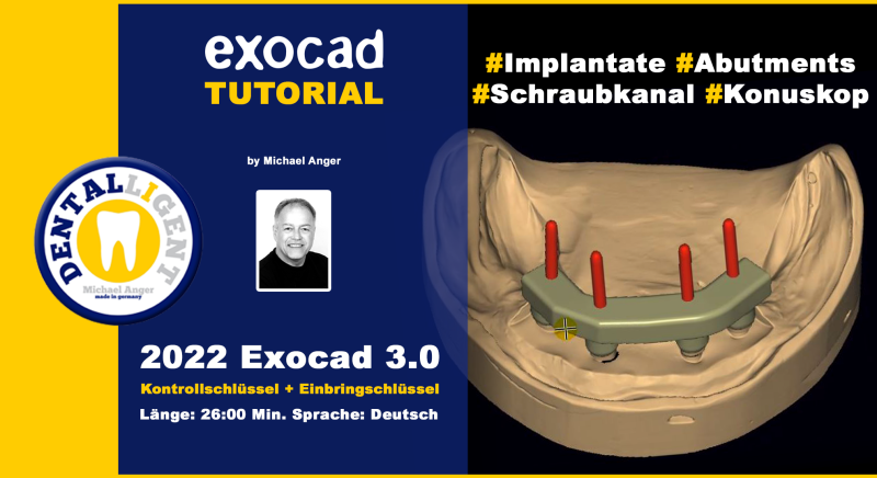 Product image 1 of the product “2022-Exocad 3.0 – Kontrollschlüssel + Einbringschlüsse ”