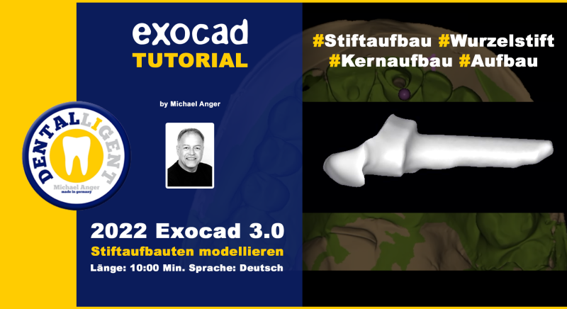 Product image 1 of the product “2022-Exocad 3.0 – Stiftaufbauten in exocad modellieren ”