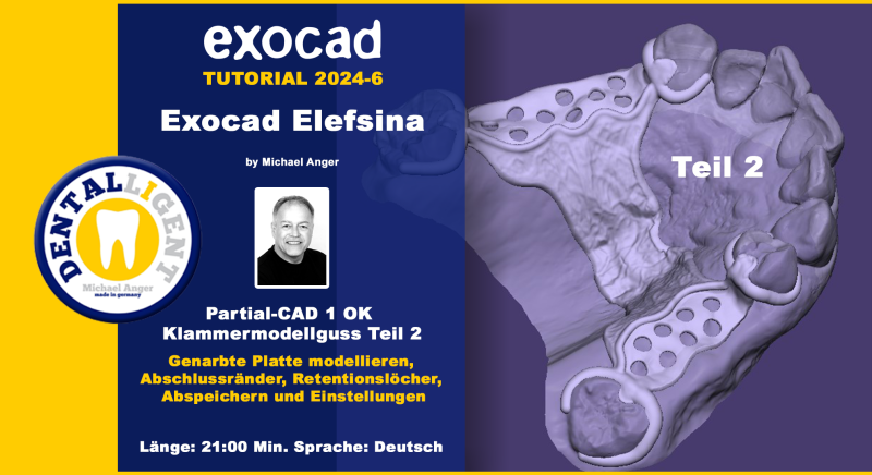 Artikelbild 1 des Artikels “Exocad Elefsina 2024-6 Partial-CAD 1 OK Klammermodellguss Teil 2 “