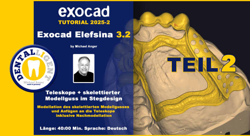 Artikelbild 1 des Artikels “Exocad Elefsina 3.2 - 2025-2 - Teleskope + skelettierter Modellguss im Stegdesign TEIL 2 “