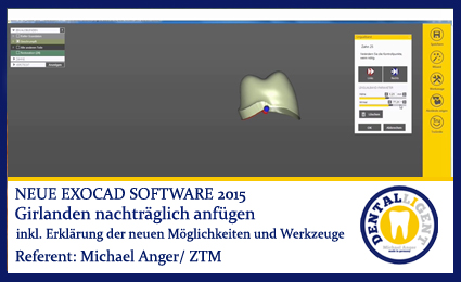 Product image 1 of the product “2015-Girlanden nachträglich anfügen - Exocad 2015 ”