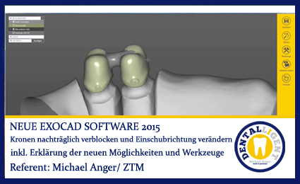 Artikelbild 1 des Artikels “2015-Kronen nachträglich verblocken und Einschubrichtung verändern - Exocad 2015 “