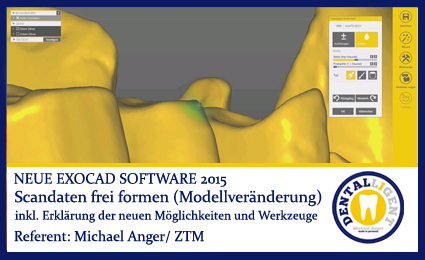 Product image 1 of the product “2015-Scandaten frei formen (Modellveränderung) - Exocad Software 2015 ”