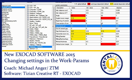 Product image 1 of the product “Changing settings in the Work-Params ”