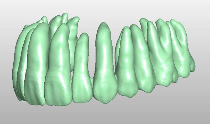 Artikelbild des Artikels “STL-Files OK & UK Zahnkranz passend zueinander zum selbst drucken “