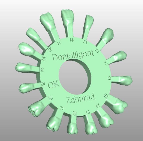 Artikelbild 2 des Artikels “STL-Files - UK & OK Zahnrad by M.Anger “