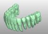 Product image 3 of the product “STL-FILES  - upper jaw & lower jaw teeth row matching each other to print by yourself. ”