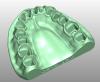 Product image 3 of the product “STL-FILES +  LIBRARY  - Upper jaw-MODELL with PIN- LIBRARY  for exocad by M. Anger ”