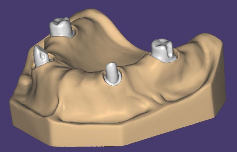Product image 3 of the product “OK-Model T2-STL-Files for self-print ”