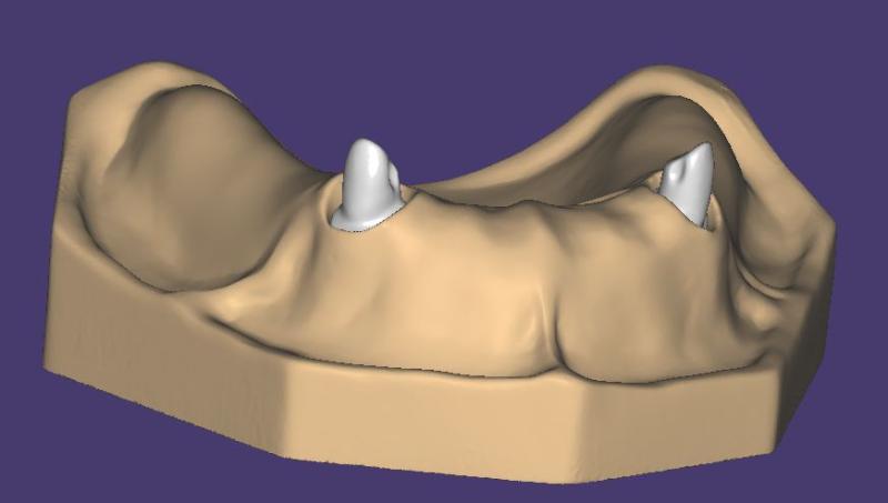 Artikelbild 3 des Artikels “OK-Modell T1-STL-Daten zum selbst drucken “
