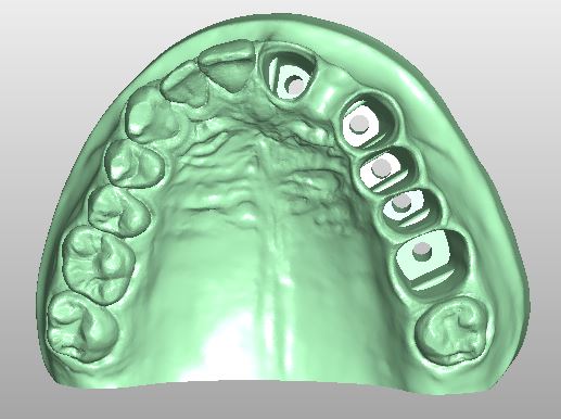 Artikelbild 3 des Artikels “OK-Modell D1-STL Daten zum selbst drucken “