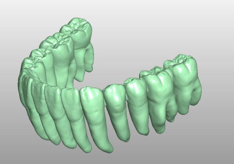Artikelbild 3 des Artikels “STL-Files OK & UK Zahnkranz passend zueinander zum selbst drucken “