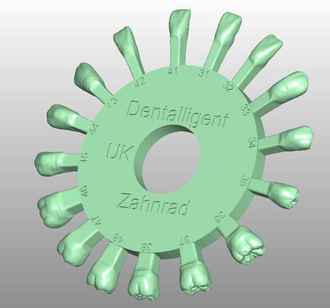 Artikelbild 3 des Artikels “STL-Files - UK & OK Zahnrad by M.Anger “
