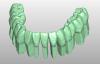 Product image 4 of the product “STL-FILES +  LIBRARY  - Upper jaw-MODELL with PIN- LIBRARY  for exocad by M. Anger ”