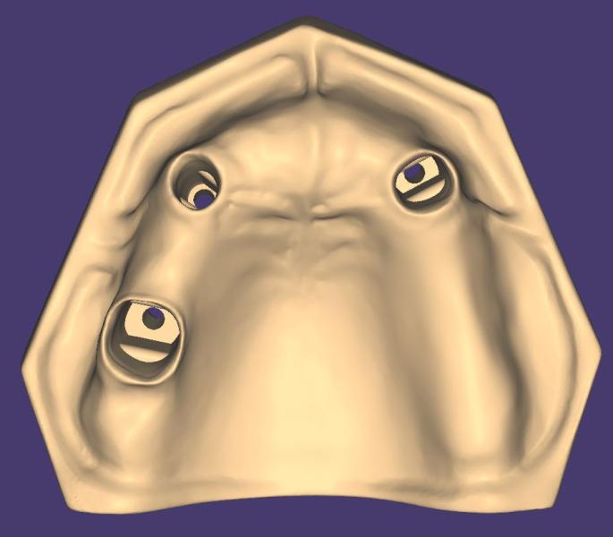 Artikelbild 4 des Artikels “OK-Modell T3-STL-Daten zum selbst drucken “