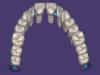 Product image 5 of the product “New Library : DENTALLIGENT-PINS ”