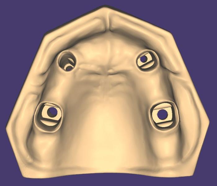 Product image 5 of the product “OK-Model T2-STL-Files for self-print ”