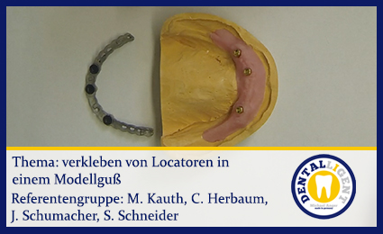 Product image of the product “verkleben von Locatoren in einem Modellguss ”