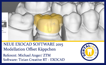 Product image 1 of the product “Modellation Offset-Käppchen ”