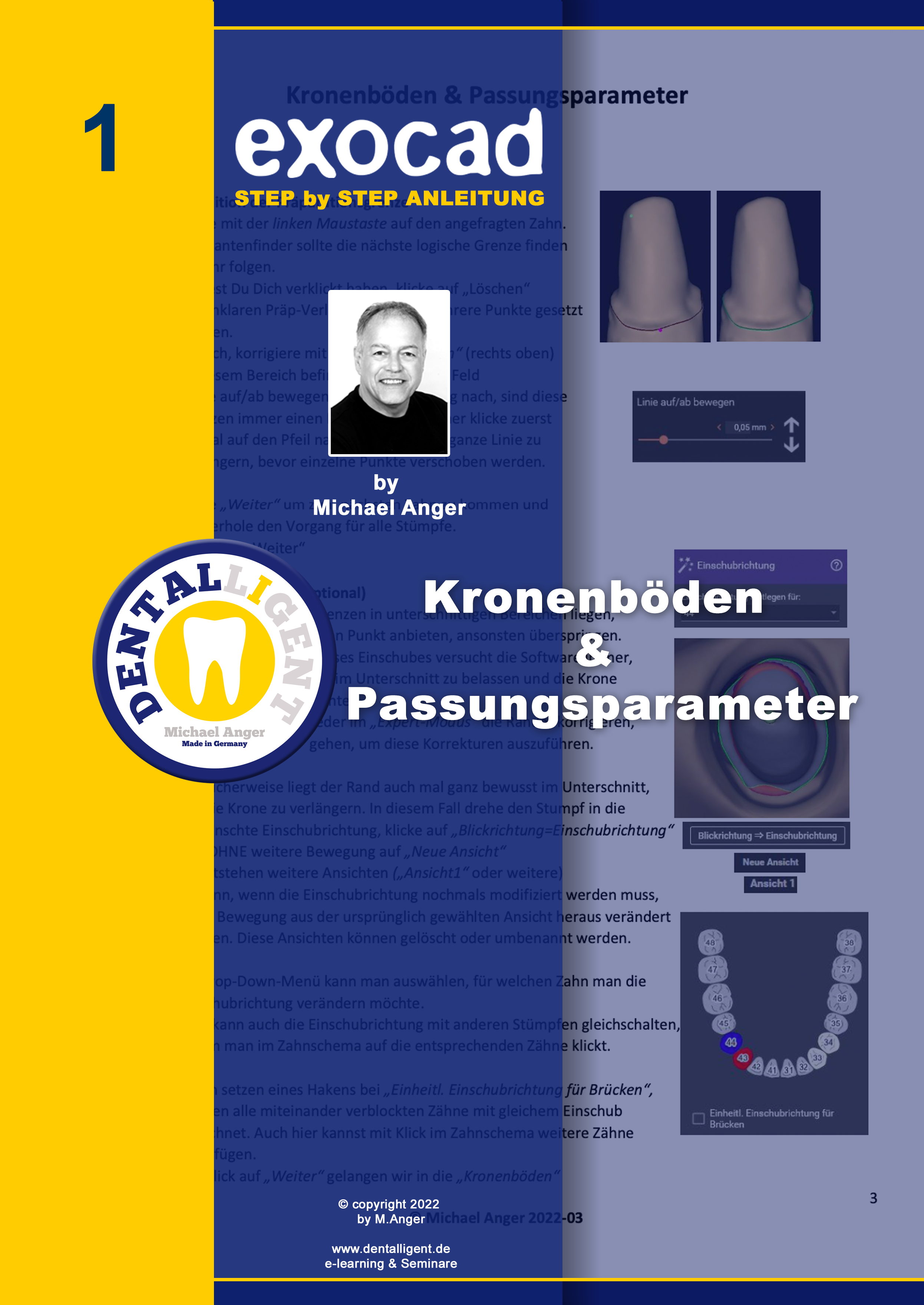 Product image 1 of the product “Exocad Step by Step Anleitung - Nr. 1 - Kronenböden & Passungsparameter ”