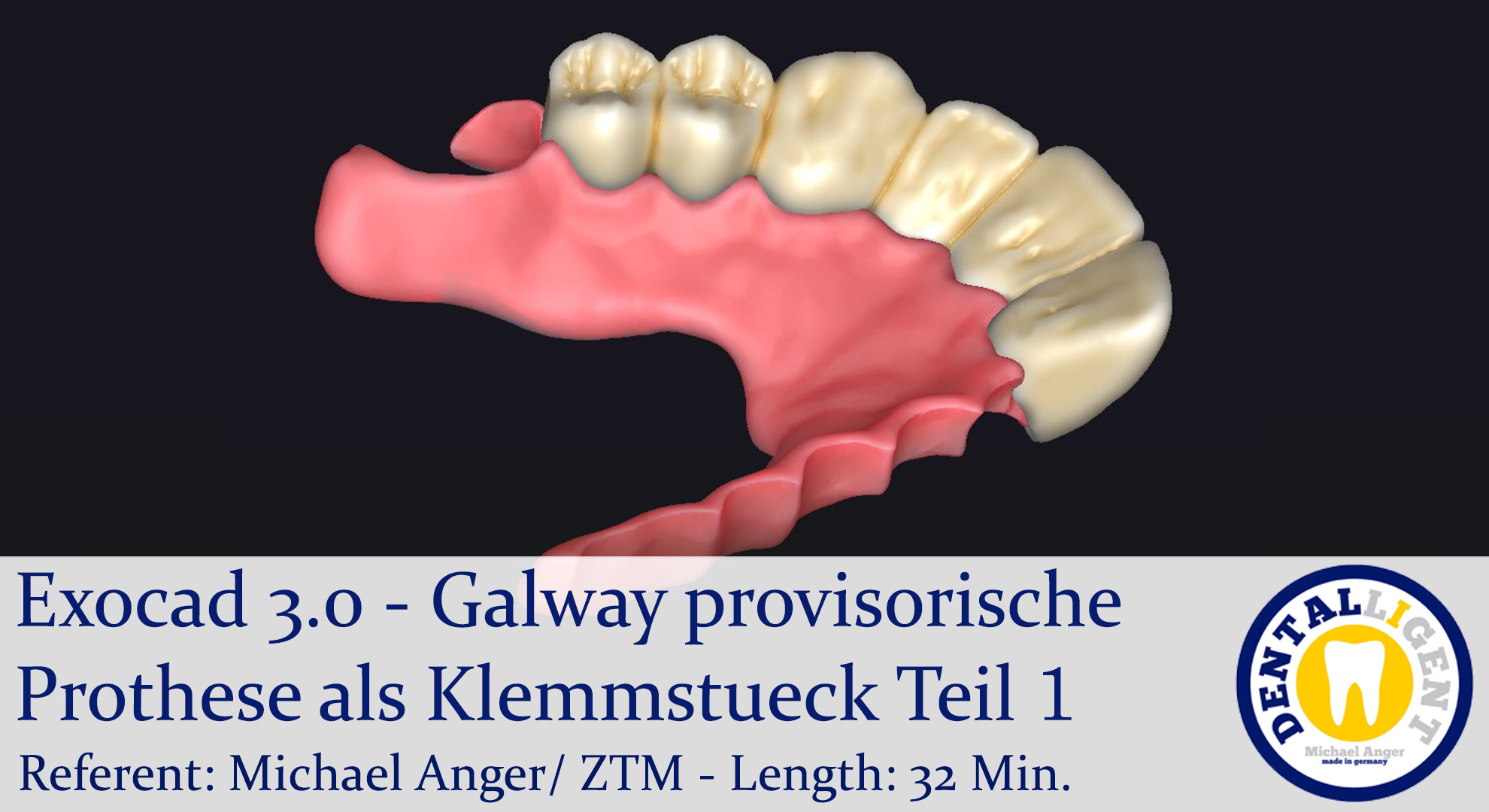 Artikelbild 1 des Artikels “2021-Exocad - Exocad 3.0 – Galway provisorische Prothese als Klemmstueck Teil 1 “