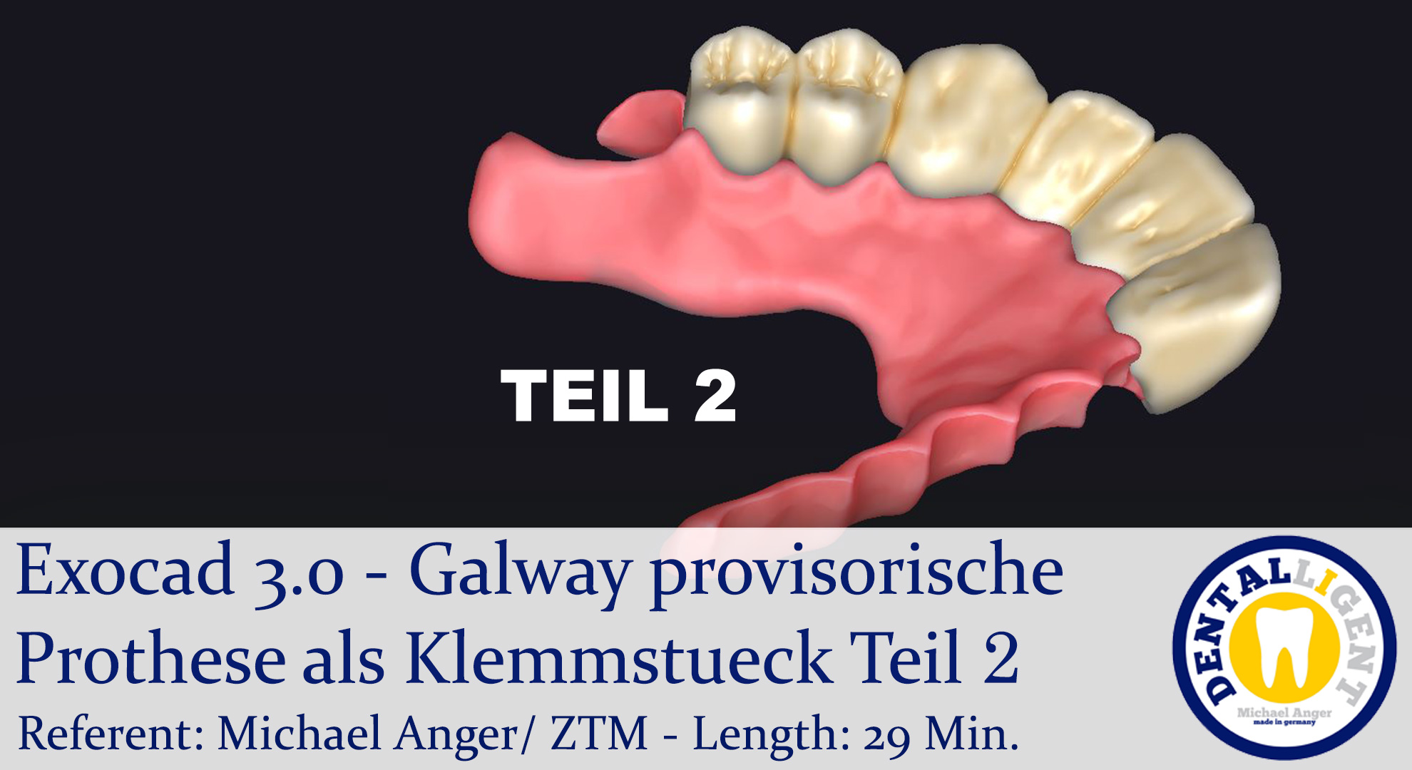 Artikelbild 1 des Artikels “2021-Exocad - Exocad 3.0 – Galway provisorische Prothese als Klemmstueck Teil 2 “