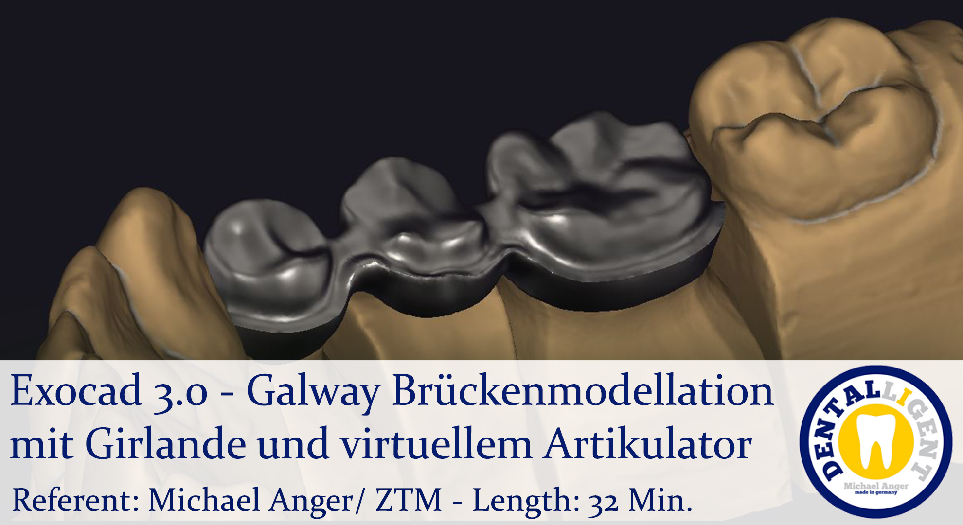 Product image 1 of the product “2021-Exocad 3.0 – Galway Brückenmodellation mit Girlande und virtuellem Artikulator ”
