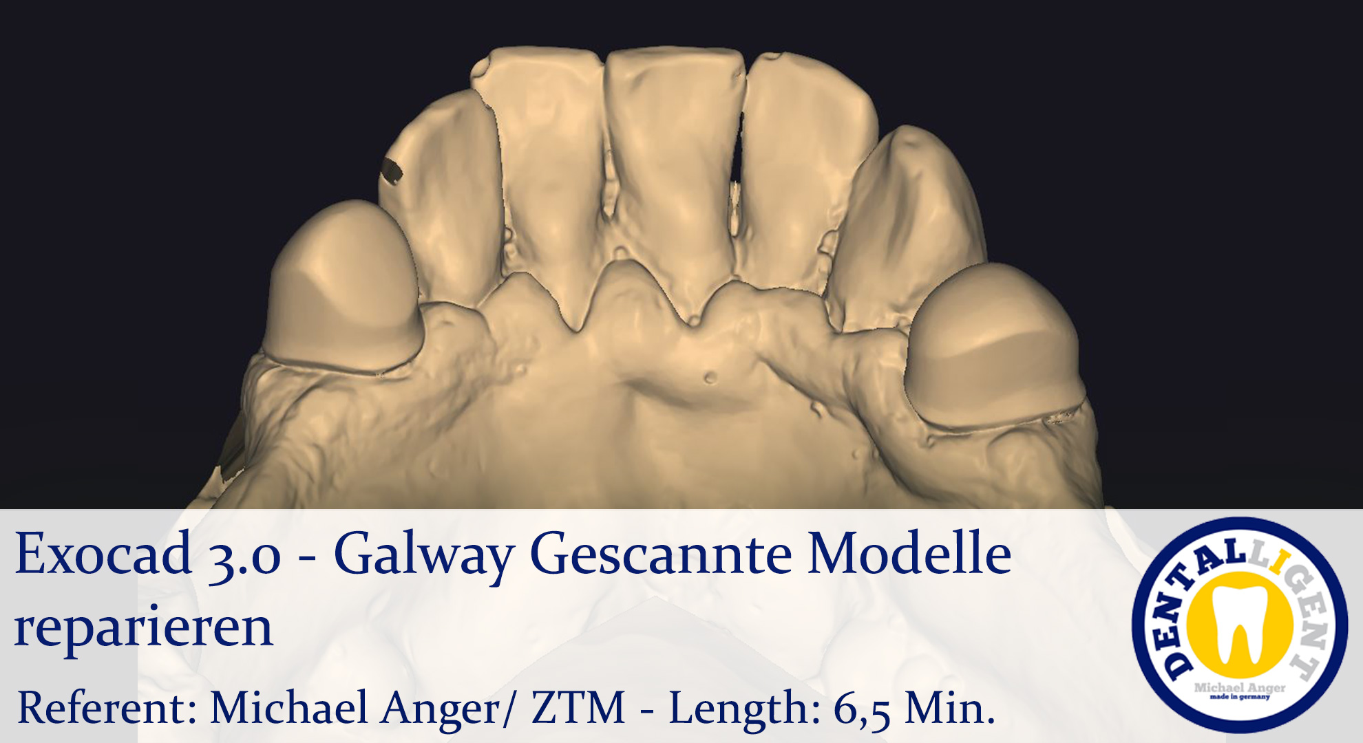 Artikelbild 1 des Artikels “2021-Exocad - Exocad 3.0 – Galway Gescannte Modelle reparieren “