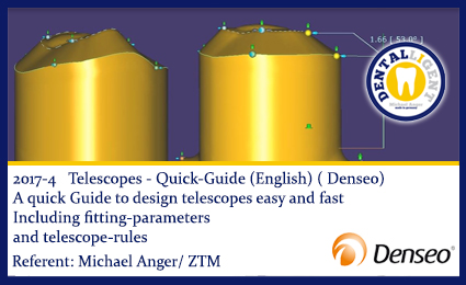 Product image 1 of the product “2017-ENGLISH -NEW EXOCAD TUTORIAL DENSEO -4 - Telescopes - Quick-Guide  (English) ”