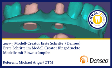 Artikelbild 1 des Artikels “2017-NEW EXOCAD TUTORIAL DENSEO -5 Modell-Creator Erste Schritte (Denseo) “
