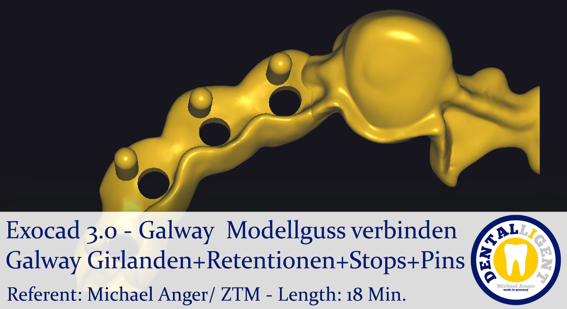 Artikelbild 1 des Artikels “2021-Exocad - Exocad 3.0 – Galway  Modellguss verbinden-Gir-Ret-Stp-Pin “