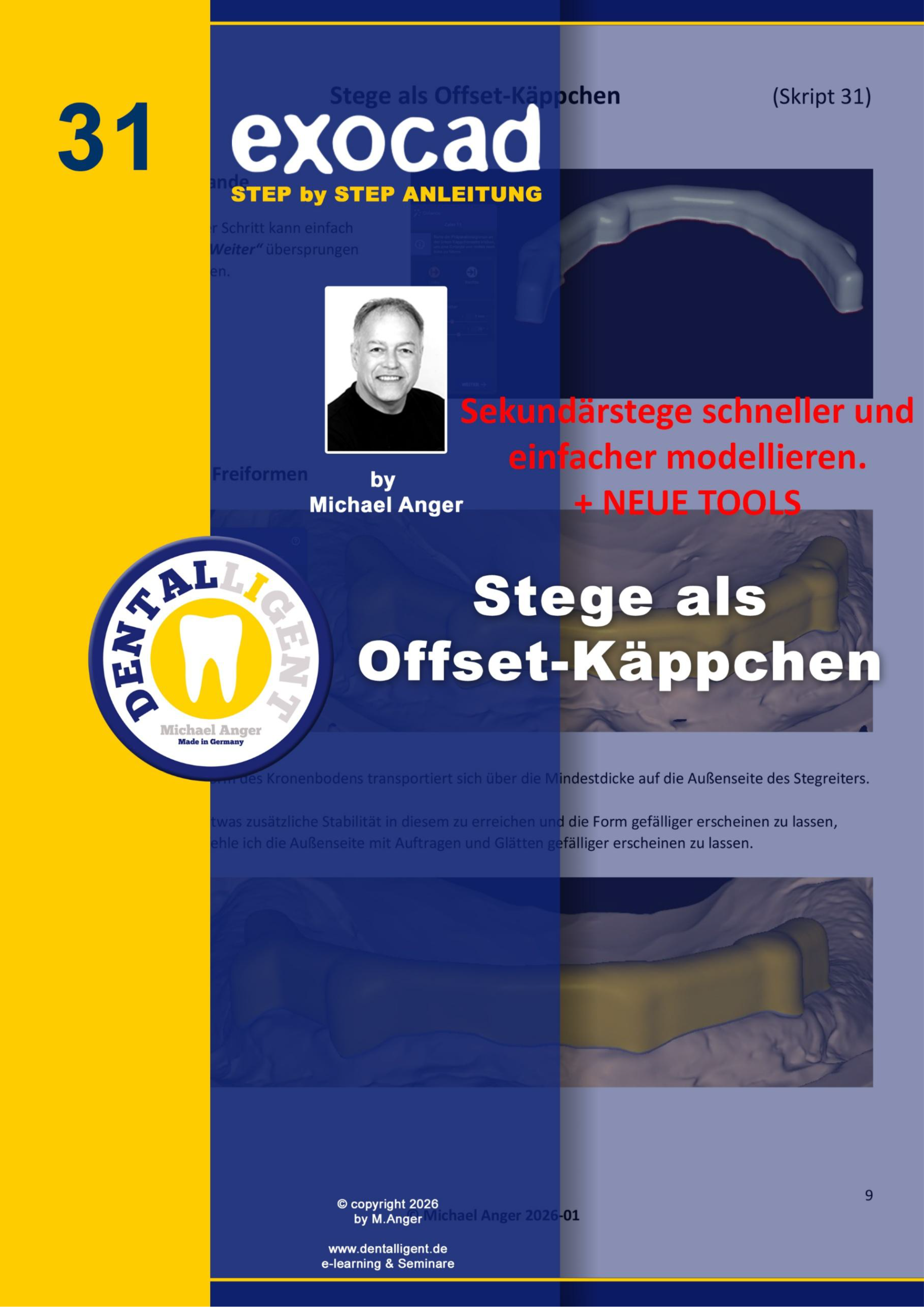 Product image 1 of the product “Exocad Step by Step Anleitung -Nr. 31 - Stege als Offset-Käppchen ”