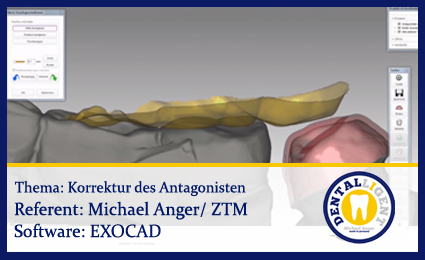 Product image 1 of the product “Korrektur des Antagonisten ”