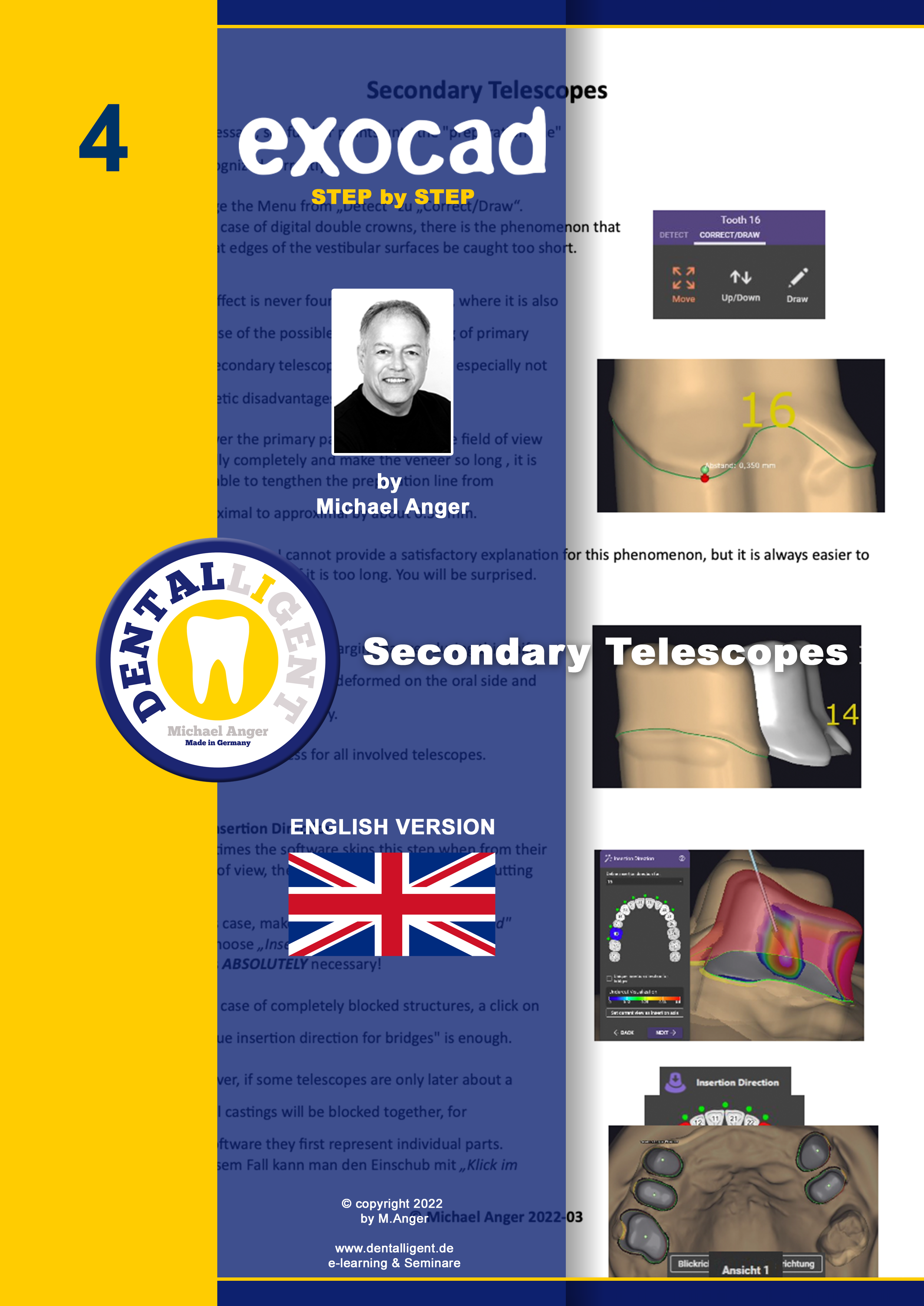 Product image 1 of the product “Exocad Step by Step - Nr.4 - Secondary  Telescopes ”