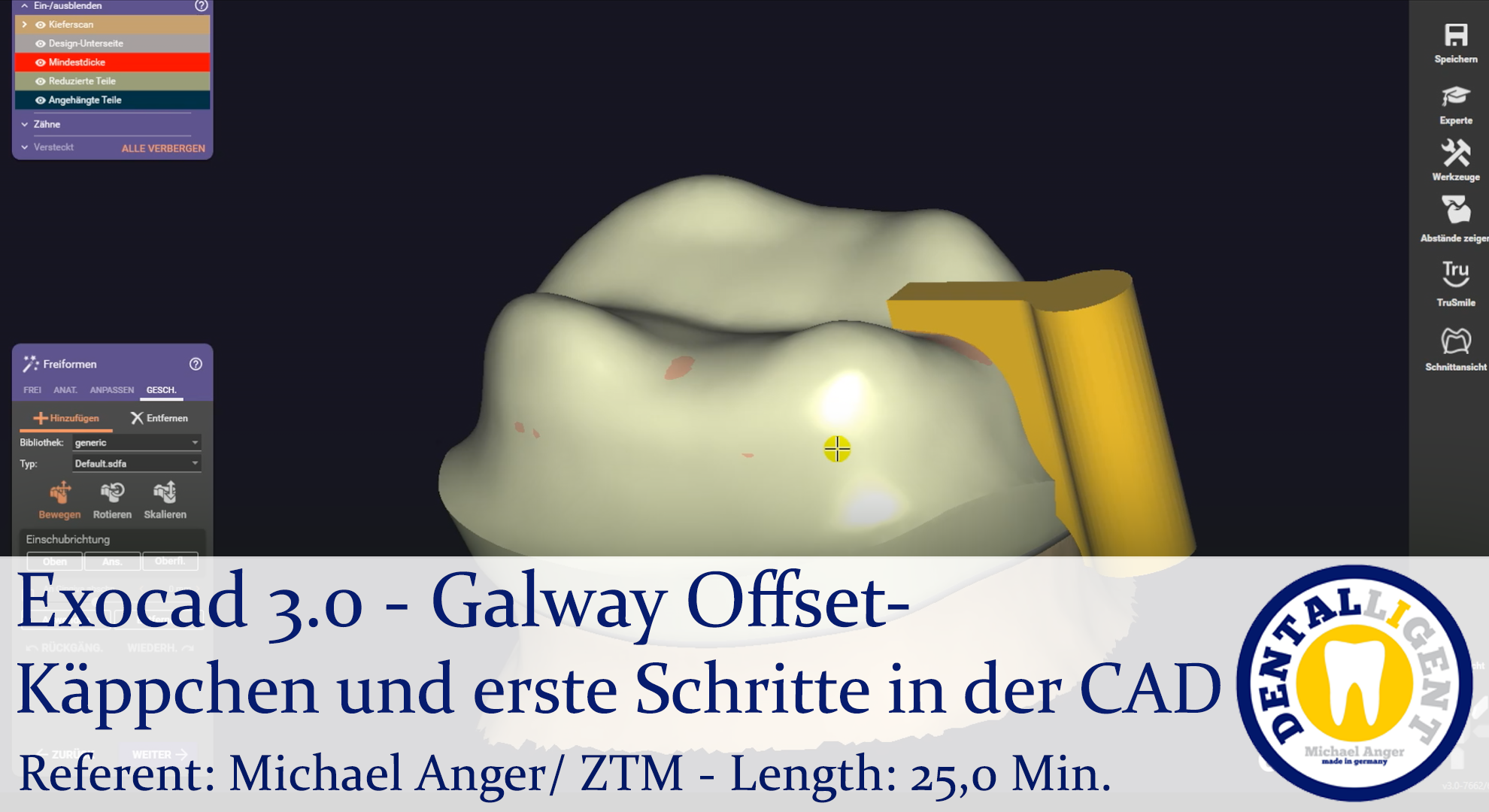 Artikelbild 1 des Artikels “2021-Exocad - Exocad 3.0 – Galway Offset-Käppchen und erste Schritte in der CAD “
