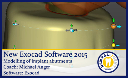 Artikelbild 1 des Artikels “Modelling of implant abutments - english “