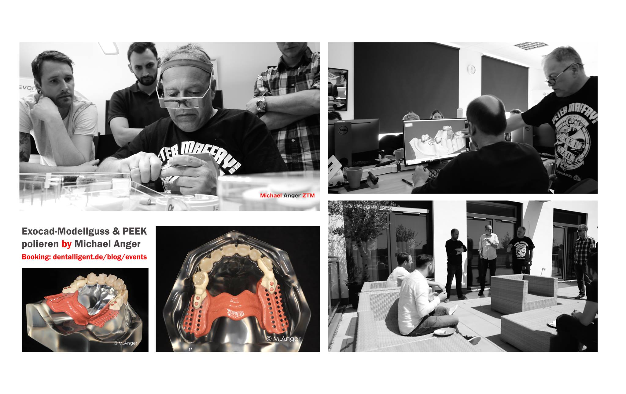 Product image 1 of the product “Exocad-Modellguss & PEEK polieren by Michael Anger ”