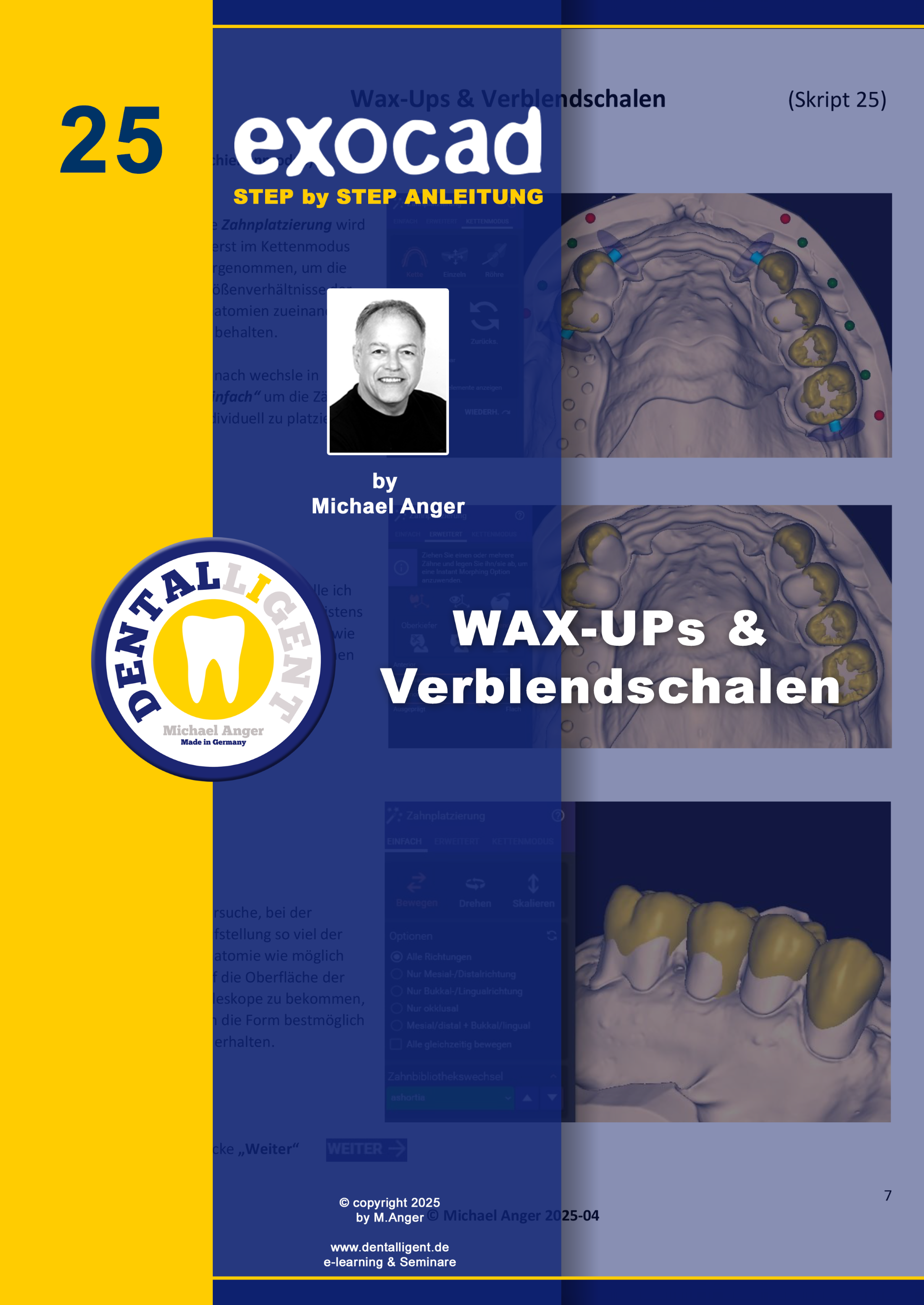 Product image 1 of the product “Exocad Step by Step Anleitung - Nr. 25 Wax Up´s & Verblendschalen ”