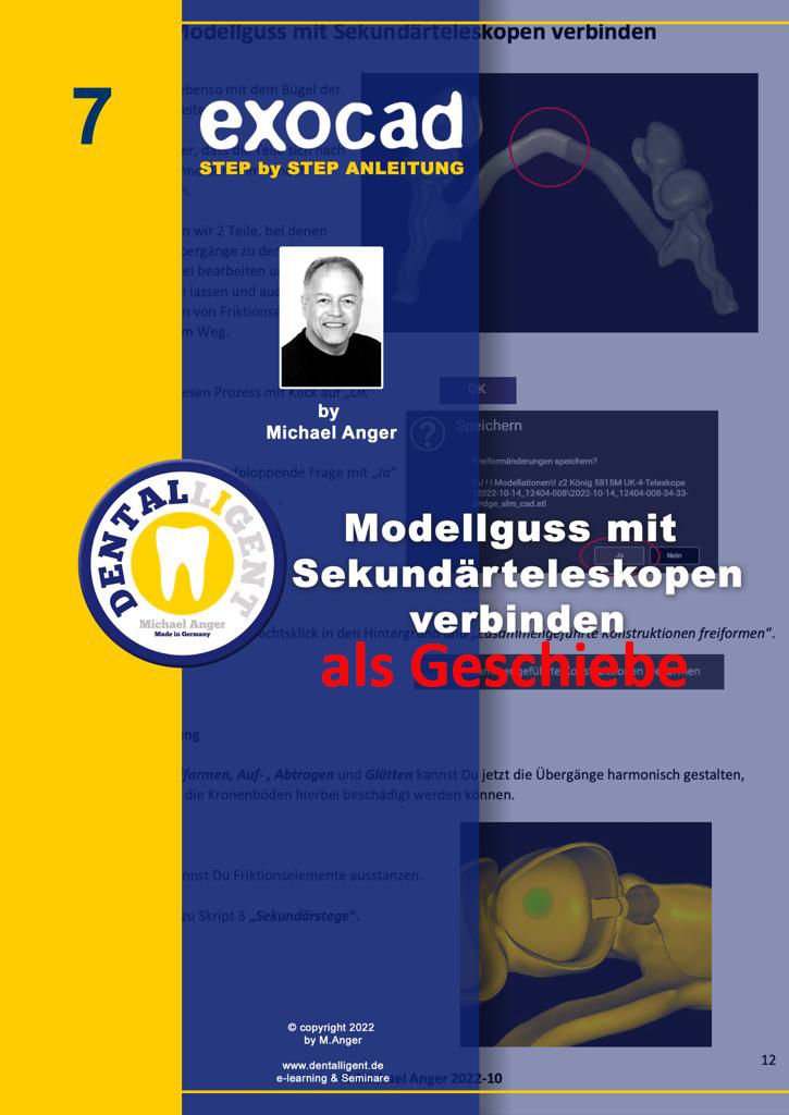 Product image 1 of the product “Exocad Step by Step Anleitung -Nr. 7 -   Modellguss mit Sekundärteleskopen verbinden ”