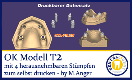 Artikelbild 1 des Artikels “OK-Modell T2-STL-Daten zum selbst drucken “