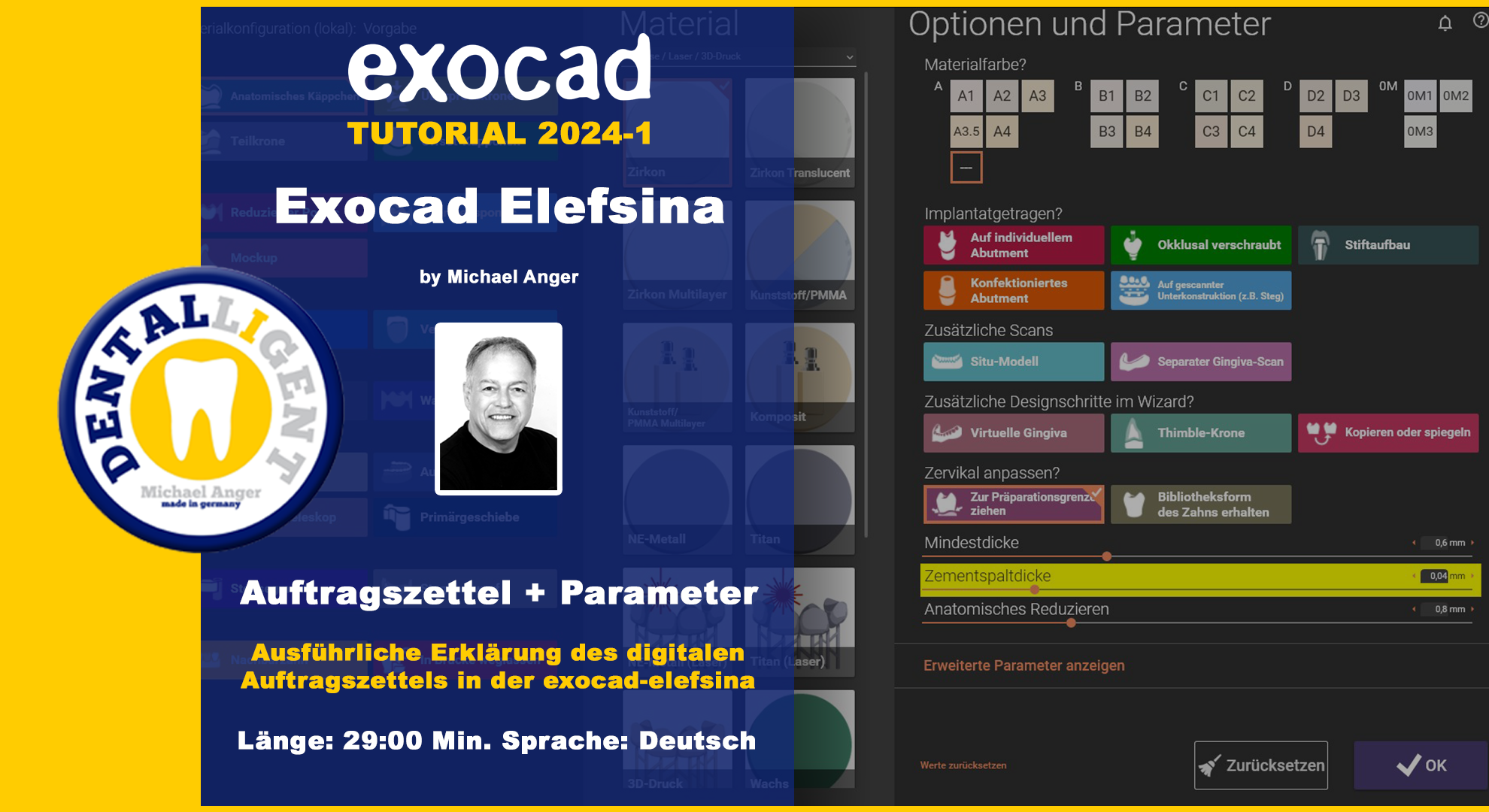 Product image 1 of the product “GRATIS - Exocad Elefsina 2024-1 Der Auftragszettel + Parameter  ”