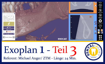 Product image 1 of the product “2019-Exocad  EXOPLAN 1 - Teil 3 ”