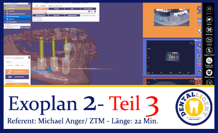 Product image 1 of the product “2019-Exocad  EXOPLAN 2 - Teil 2 ”