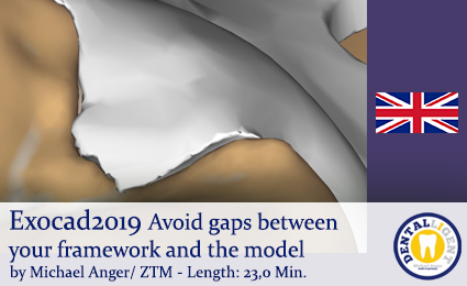 Artikelbild 1 des Artikels “2019-Exocad - Avoid gaps during exocad model casting “